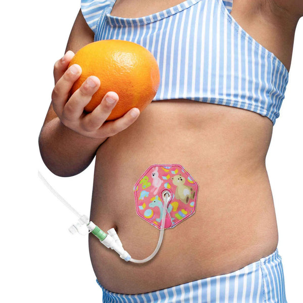 Almofadas de gastrostomia para crianças – Estampas fofas e conforto suave | Kaio-Tube Pads