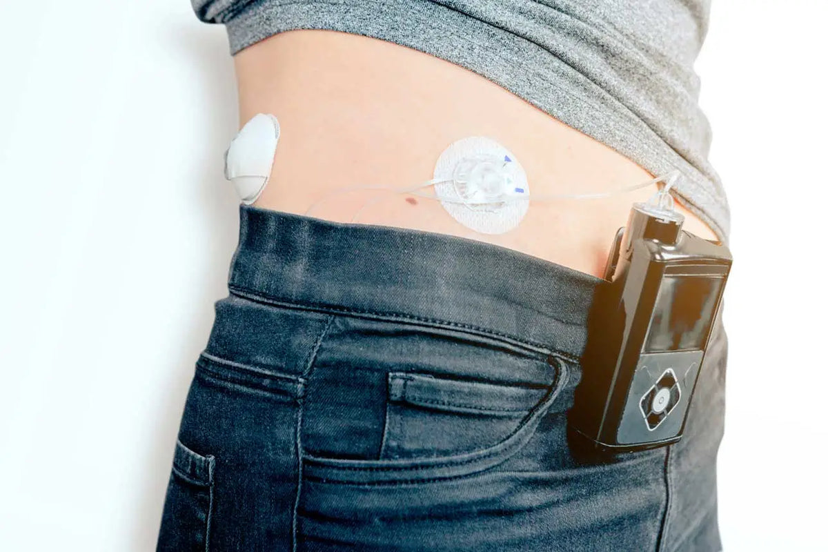 The Closed-Loop System for Diabetes