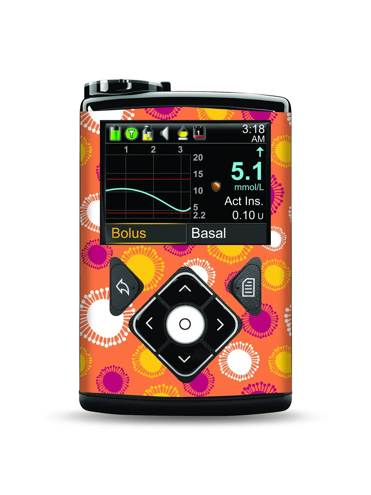 Medtronic MiniMed with Summer Edition tropical-themed stickers, adding vibrant color and protection.