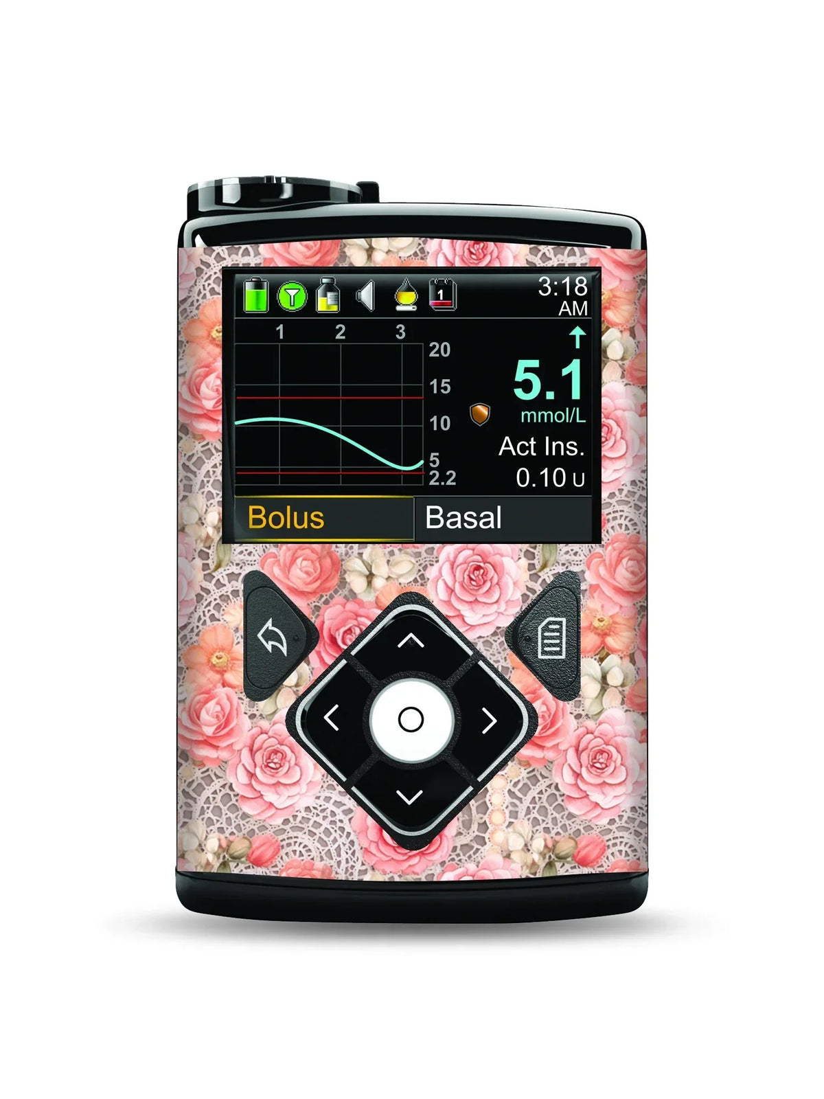 Medtronic MiniMed with Summer Edition stickers in vibrant tropical designs.