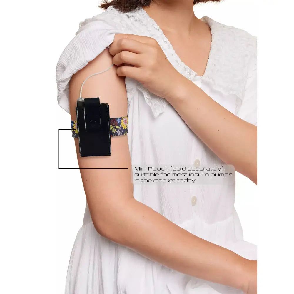 Insulin pump on arm using Dia-Arm Band for diabetics.